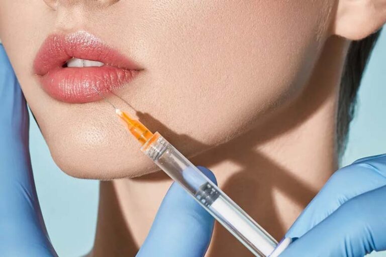 مراقبت های بعد از تزریق ژل لب