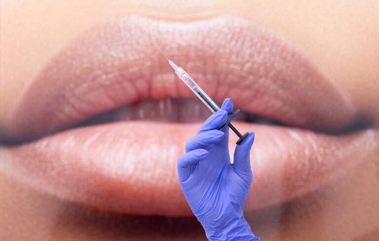 تزریق ژل لب برای چه کسانی ممنوع است؟