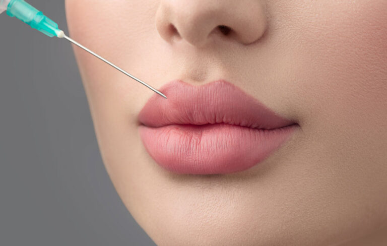 تفاوت ژل لب روسی و نچرال