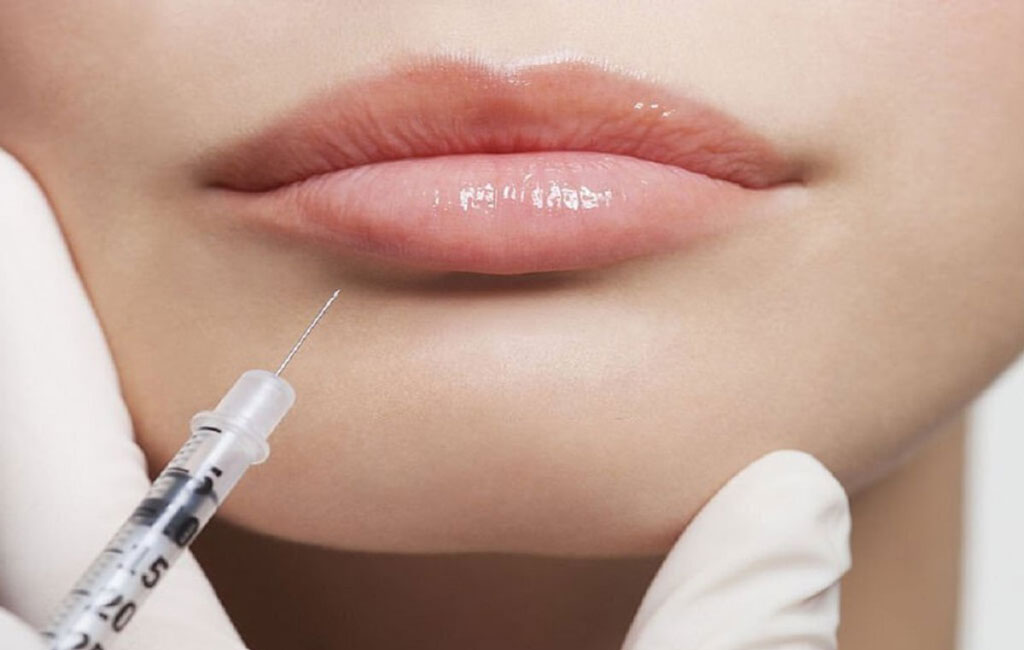 مزایا و معایب ژل لب روسی و نچرال چیست؟
